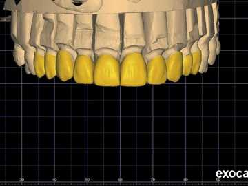 Dental Cad Service: DISEÑO DENTAL 