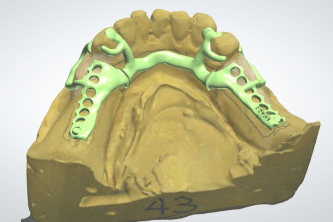 Framework Design - CadCam Masters