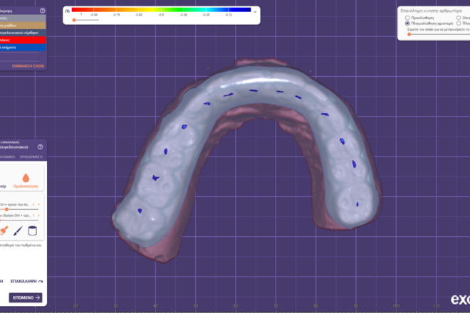 Occlusal Night Guard - CadCam Masters