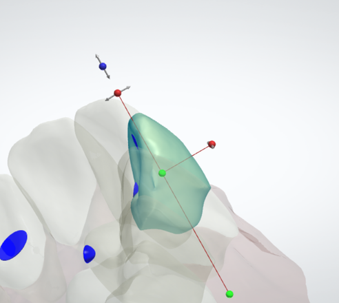 Digital Orthodontics. Stl files ready to print - CadCam Masters