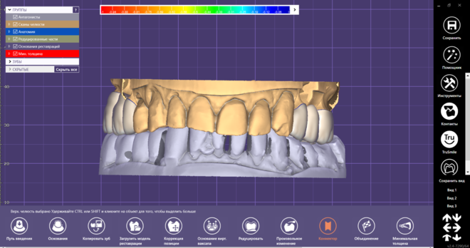 Crown & Bridge full anatomy Creation 