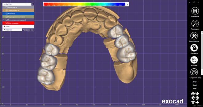 Crown & Bridge full anatomy Creation 