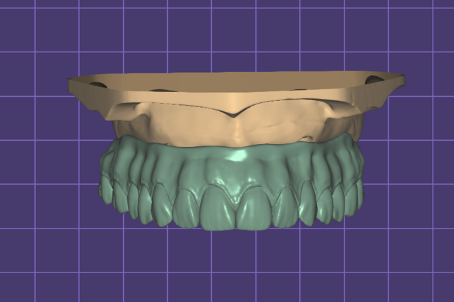 Crown and bridges designs - CadCam Masters