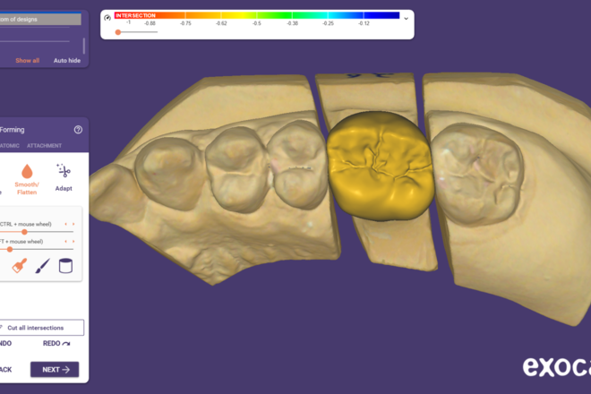 Crown & Bridge - CadCam Masters